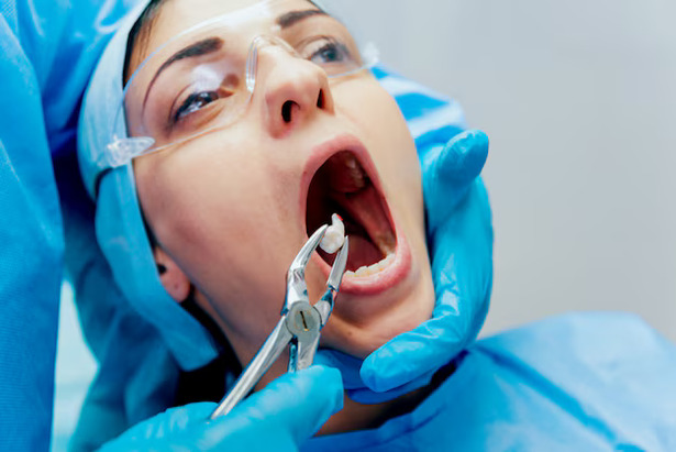 dentist-using-surgical-pliers-remove-decaying-tooth-modern-dental-clinic_179755-5038 (1)