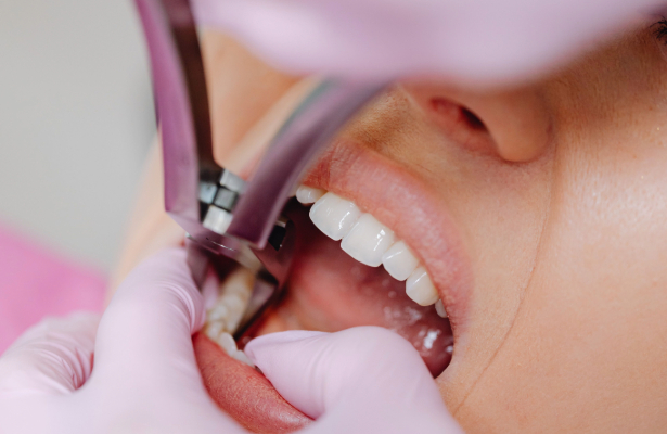 tooth-extraction